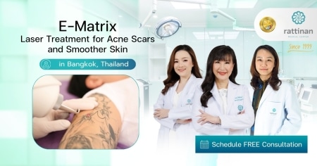 E-Matrix Laser Treatment for Acne Scars and Smoother Skin in Bangkok, Thailand