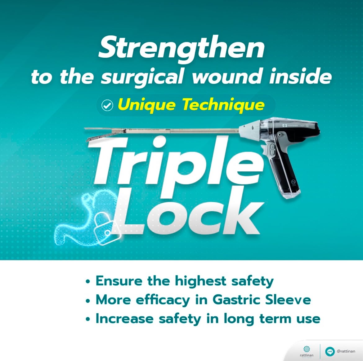 triple lock