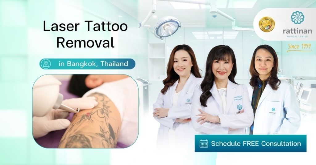 Laser Tattoo Removal in Bangkok, Thailand