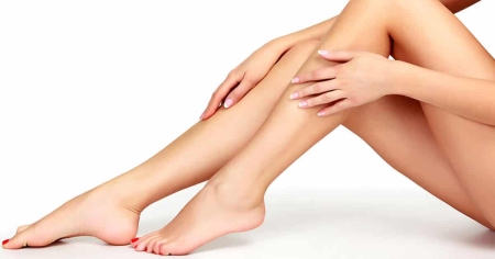 varicose veins