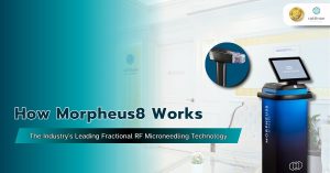 How Morpheus8 Works