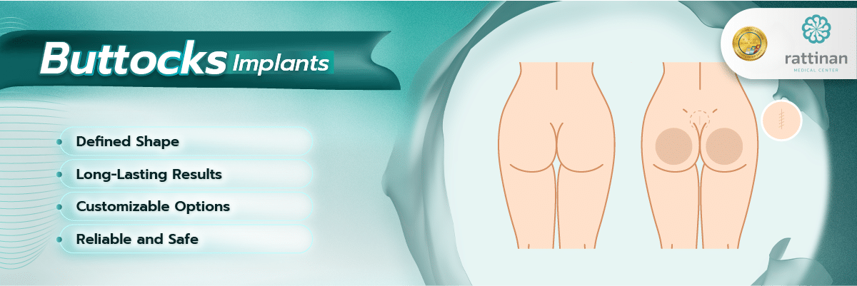 Buttock Implants