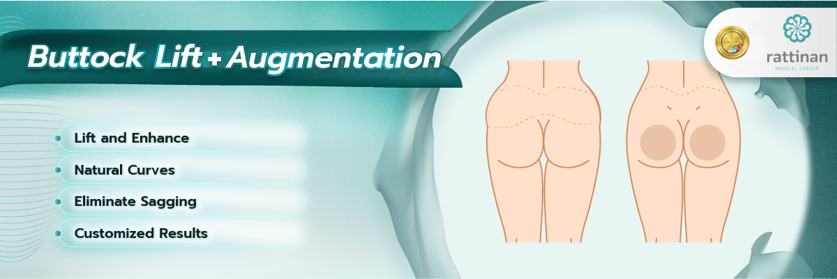 Buttock Lift + Augmentation