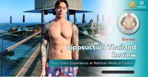Liposuction Thailand Review