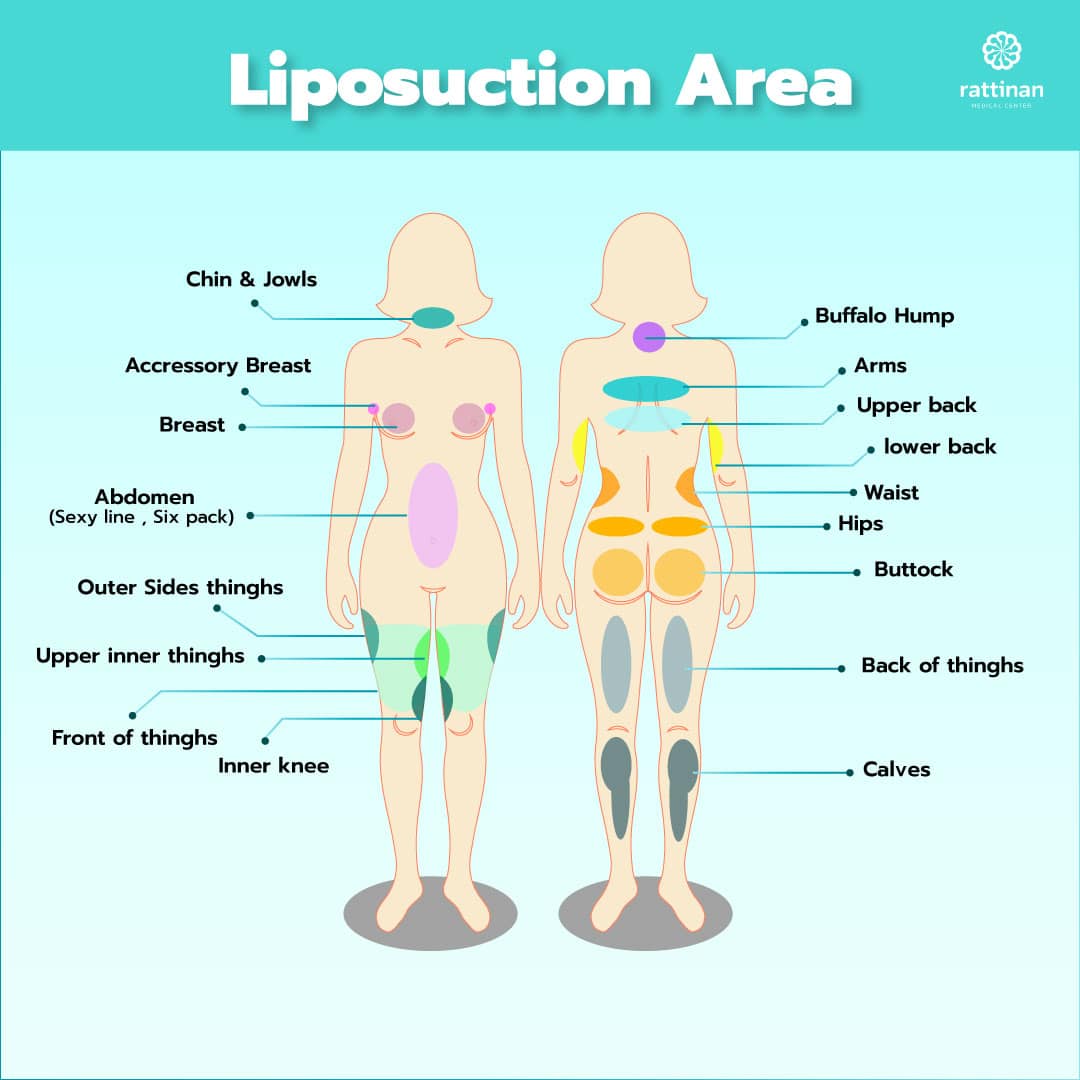 liposuction bangkok area