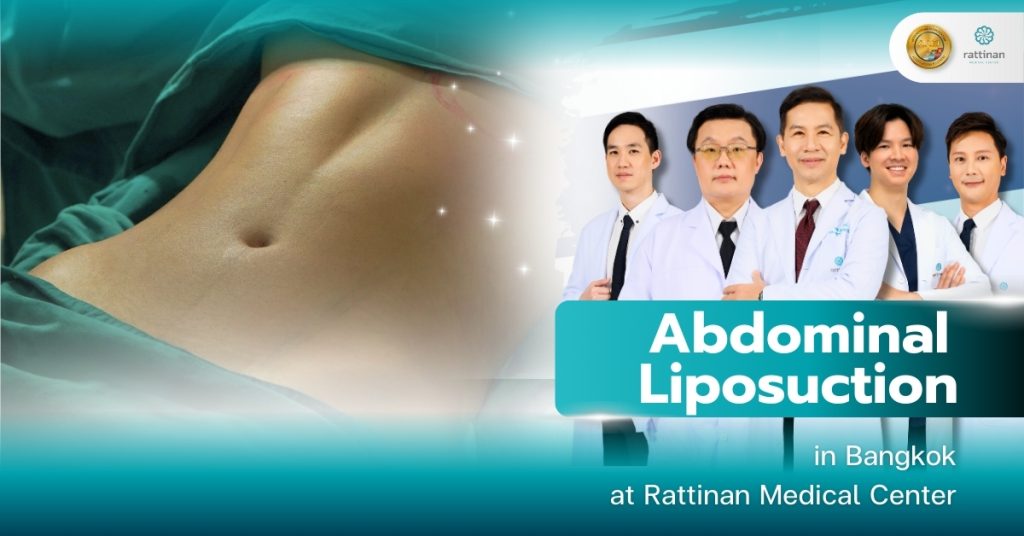 Abdominal Liposuction in Bangkok