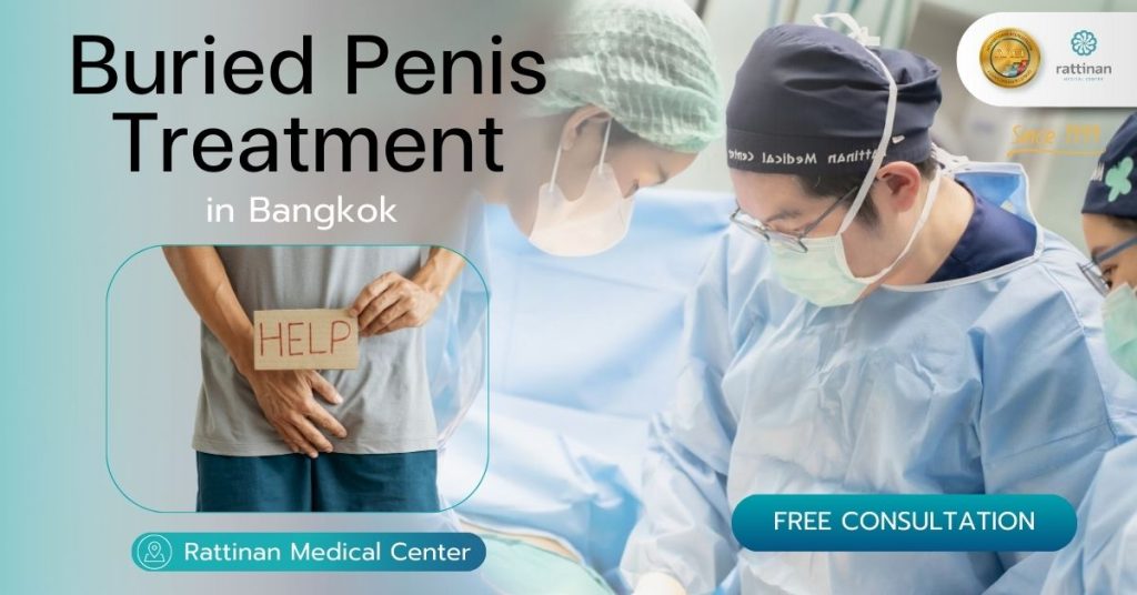 Buried Penis Treatment