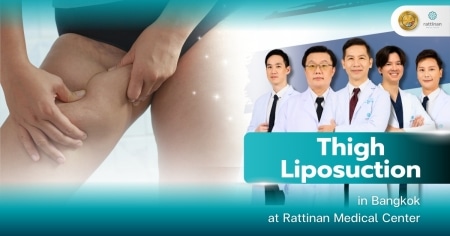 Thigh Liposuction in Bangkok