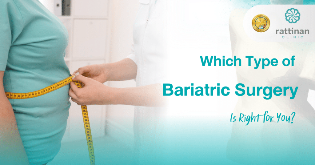 Which Type of Bariatric Surgery Is Right for You