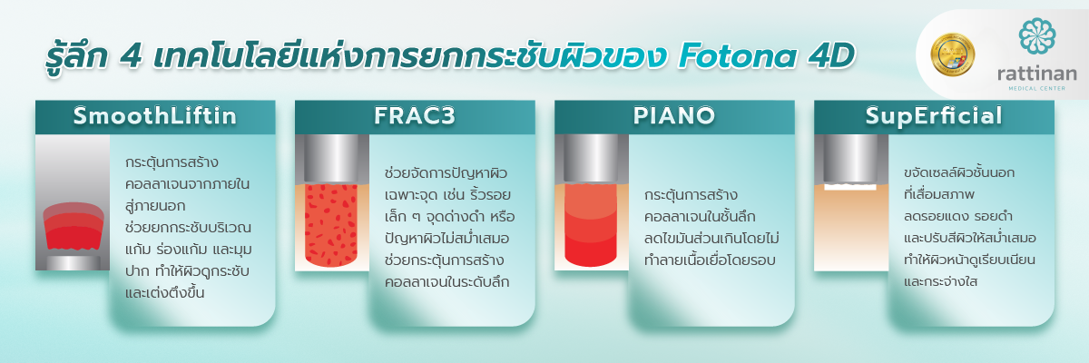 4 เทคโนโลยีแห่งการยกกระชับผิวของ Fotona 4D