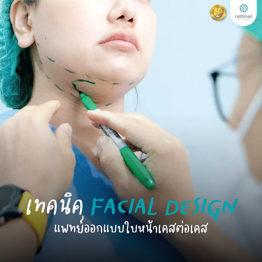 Facial Desidn ออกแบบเคสต่อเคส เหนียง