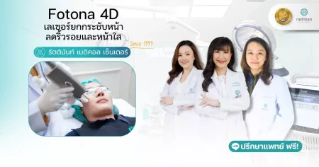 Fotona 4D เลเซอร์ยกกระชับหน้า