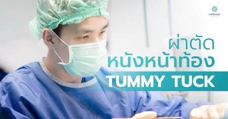 tummy tuck