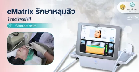 eMatrix รักษาหลุมสิว