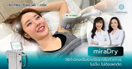 miraDry มิราดราย เลเซอร์รักแร้