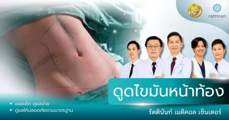 ดูดไขมันหน้าท้อง