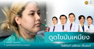 ดูดไขมันเหนียง