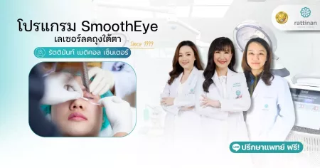 โปรแกรม SmoothEye เลเซอร์ลดถุงใต้ตา