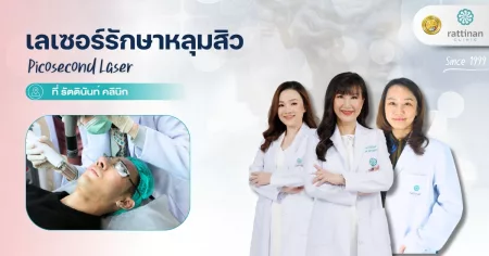 เลเซอร์รักษาหลุมสิว Picosecond Laser รัตตินันท์