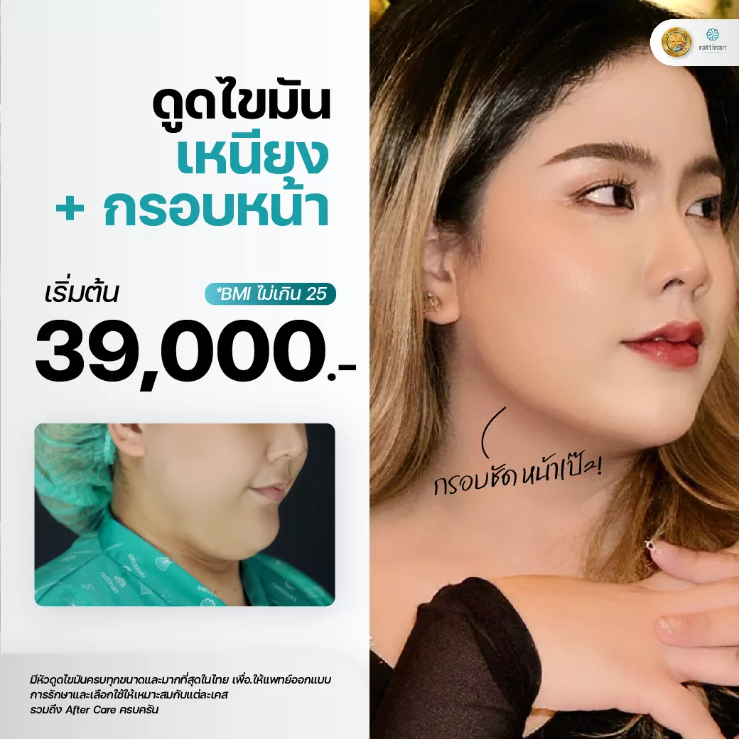 ดูดไขมันเหนียง ราคา