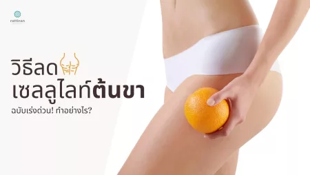 วิธีลดเซลลูไลท์ต้นขา ทำอย่างไร