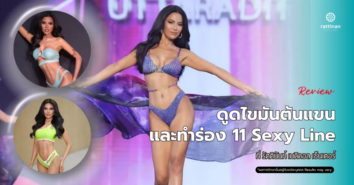 รีวิว ดูดไขมันต้นแขน และทำร่อง 11 Sexy Line