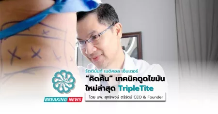 คิดค้นเทคนิคดูดไขมันใหม่ล่าสุด TripleTite