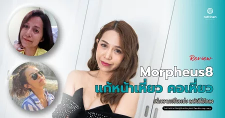 รีวิว Morpheus8