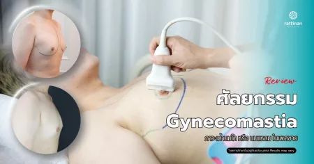 รีวิว ศัลยกรรม Gynecomastia