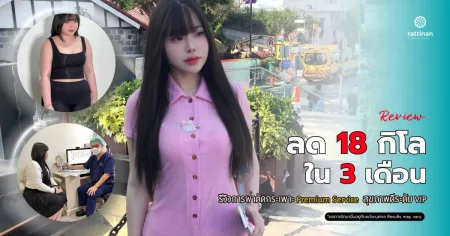 รีวิวการผ่าตัดกระเพาะ