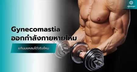 Gynecomastia ออกกำลังกายหายไหม