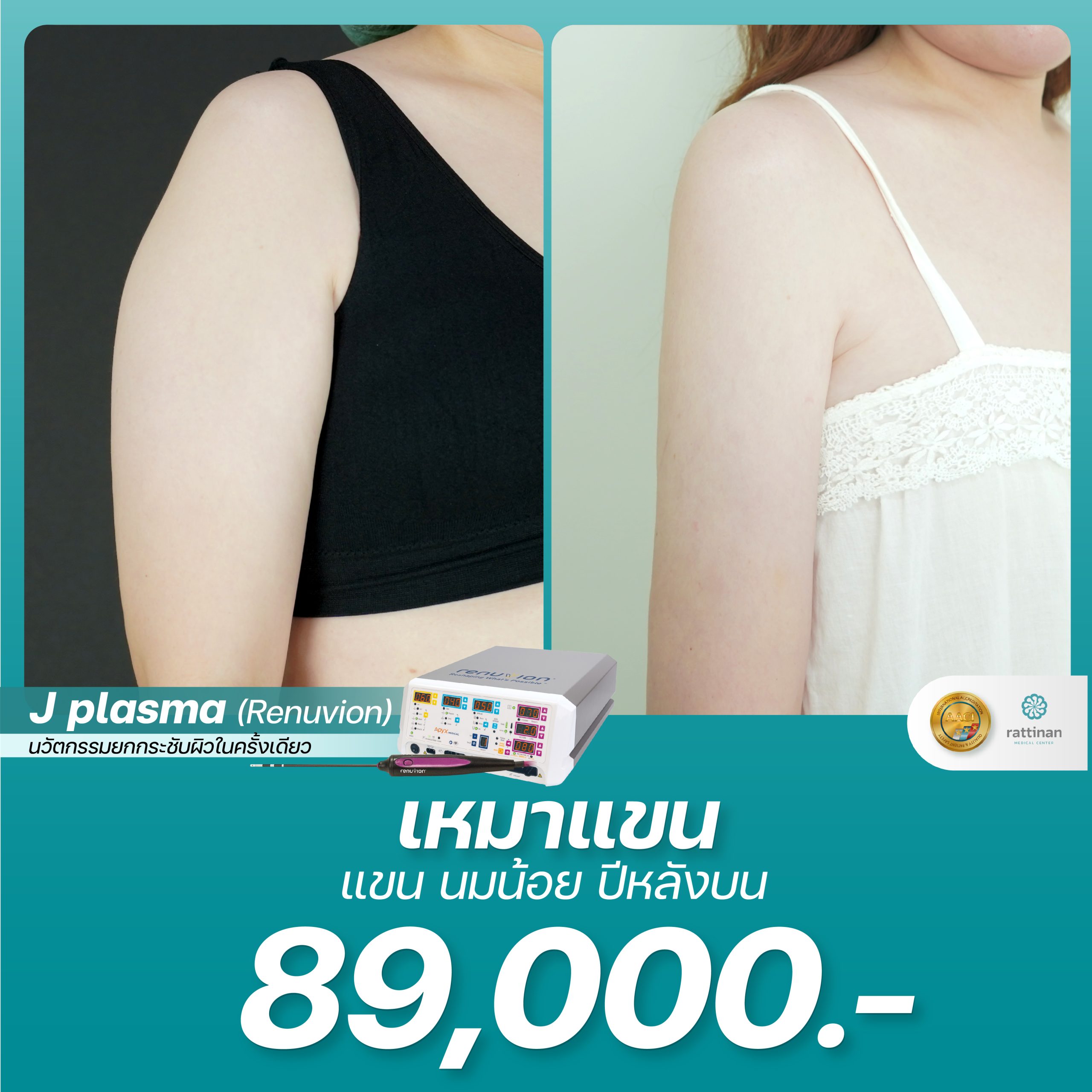 J Plasma ราคาเท่าไหร่