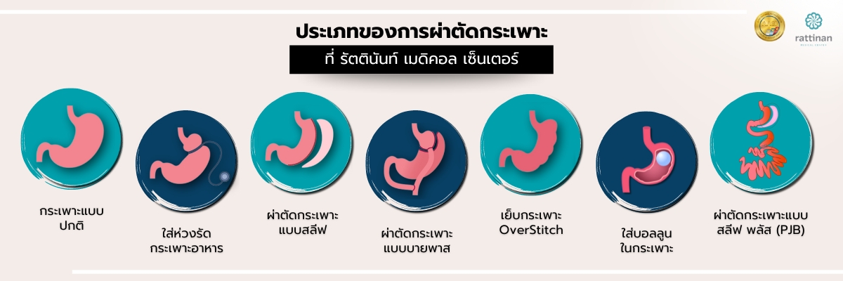 การผ่าตัดกระเพาะ 7 ประเภท