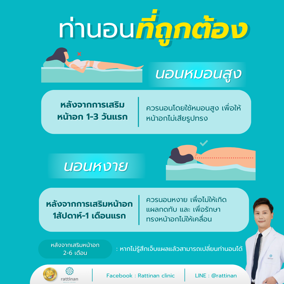 การนอนหลังผ่าตัดเสริมหน้าอกที่ถูกวิธี นอนอย่างไร