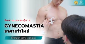 Gynecomastia ราคา