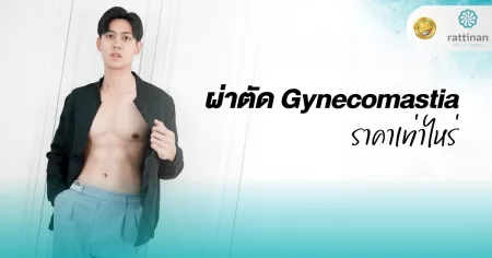 ผ่าตัด Gynecomastia ราคาเท่าไหร่