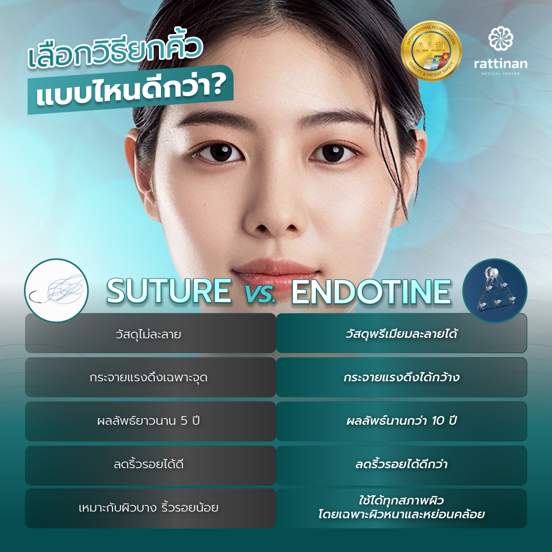 ยกคิ้ว ไหม suture หรือ Endotine