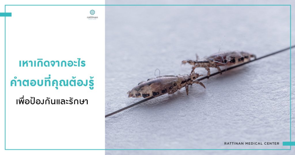 เหาเกิดจากอะไร