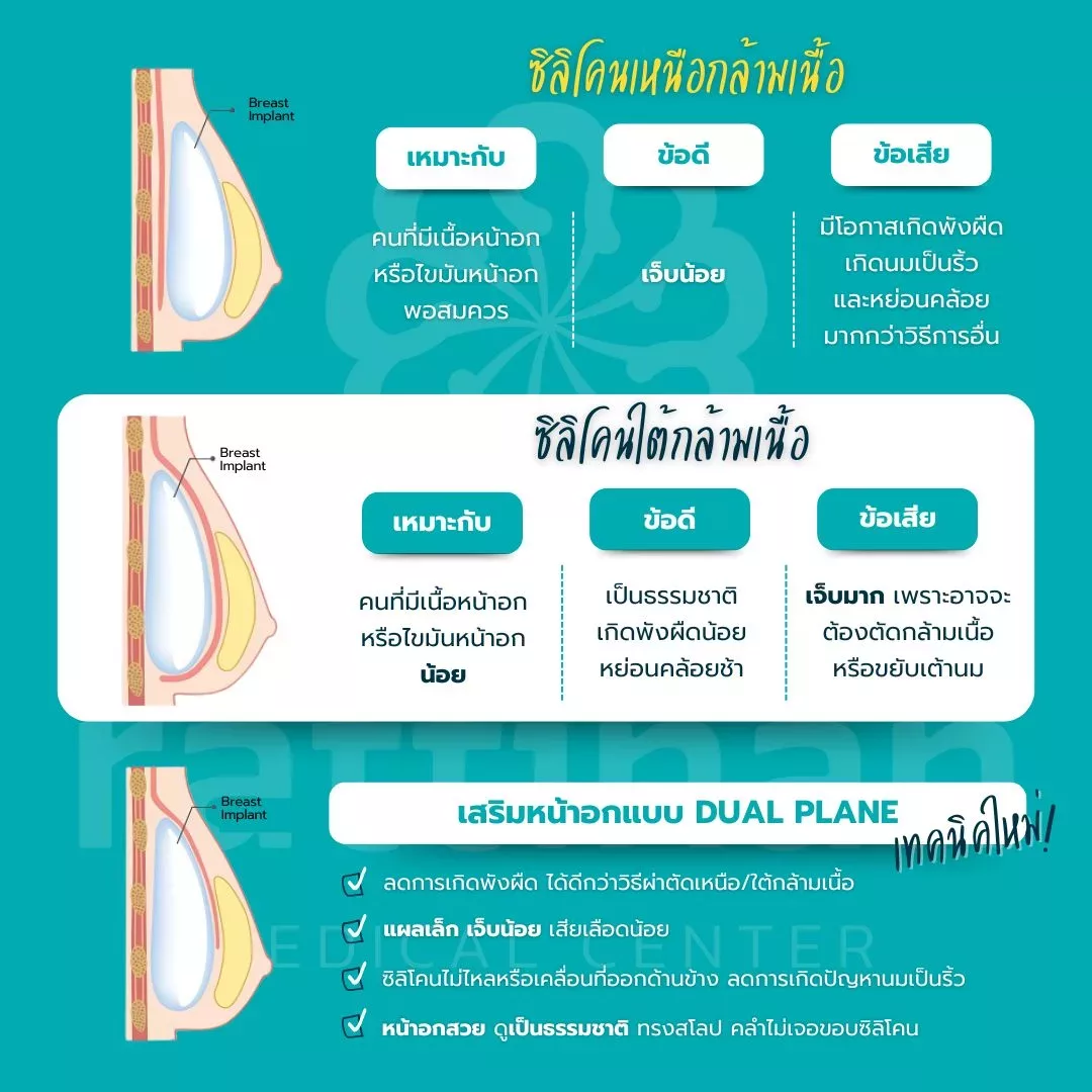 เสริมหน้าอกที่รัตตินันท์ ซิลิโคน