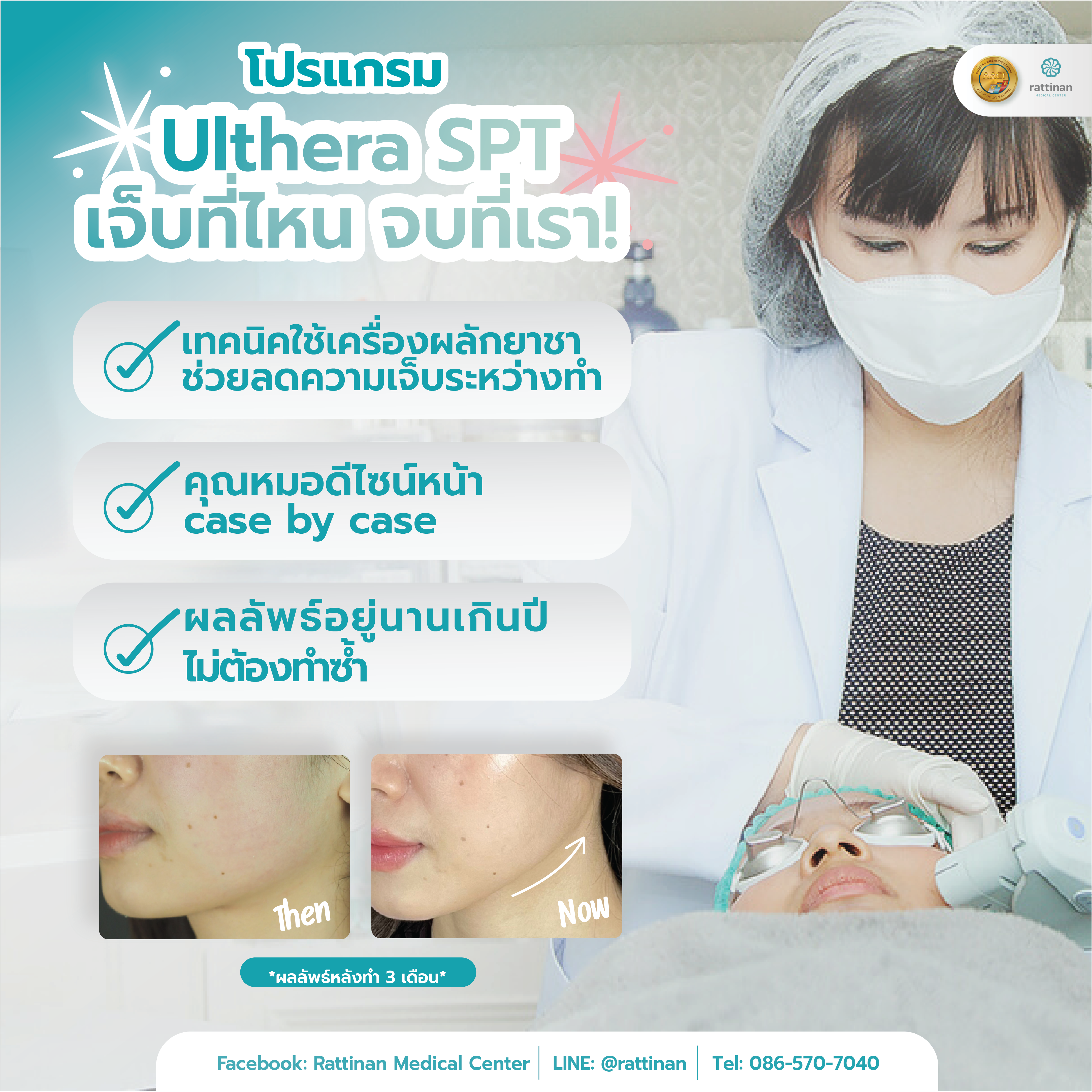 โปรแกรม Ultherapy ที่รัตตินันท์