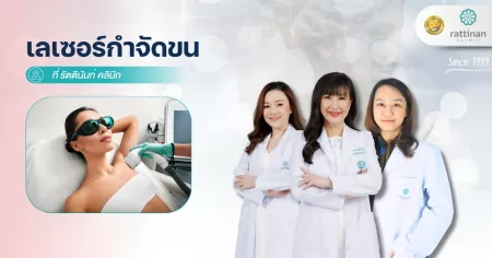 เลเซอร์กำจัดขน รัตตินันท์