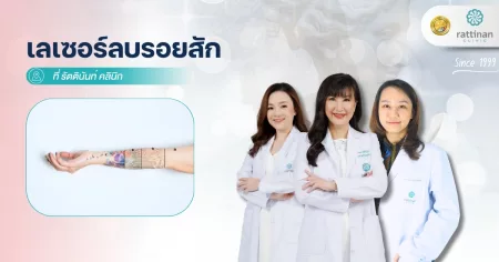 เลเซอร์ลบรอยสัก รัตตินันท์