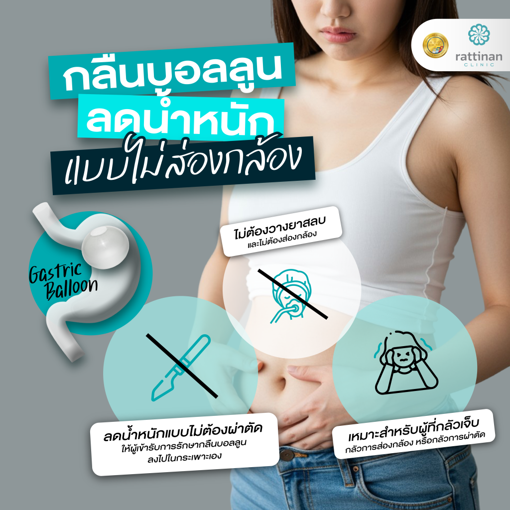 กลืนบอลลูน ลดน้ำหนัก แบบไม่ส่องกล้อง