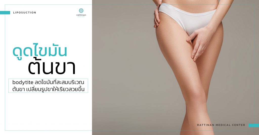 legs liposuction service