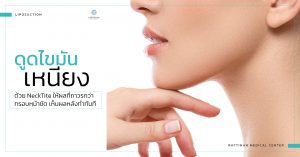 chin liposuction service