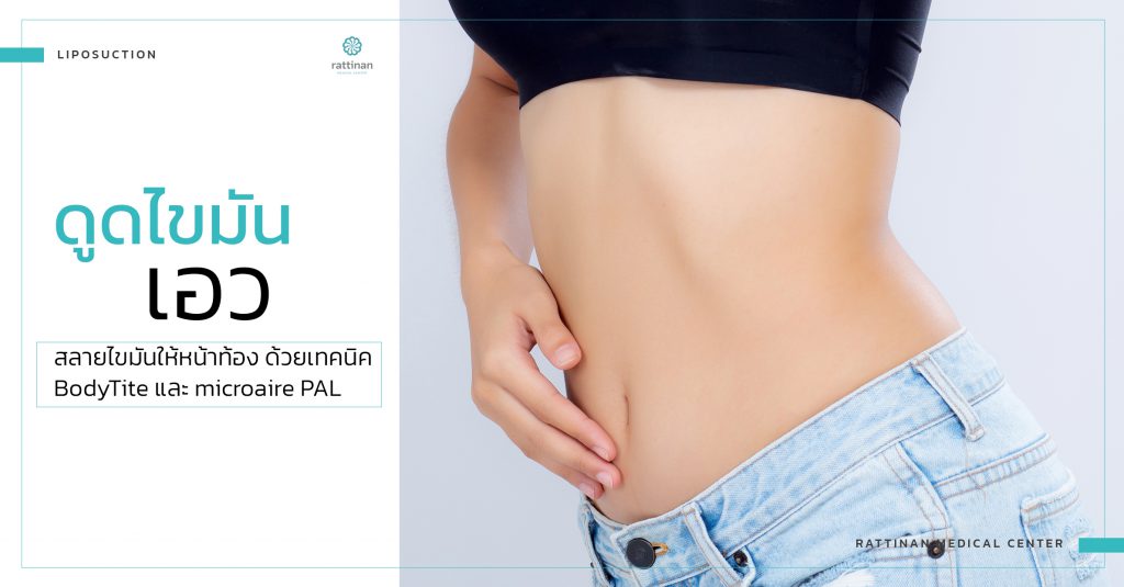 waist liposuction service